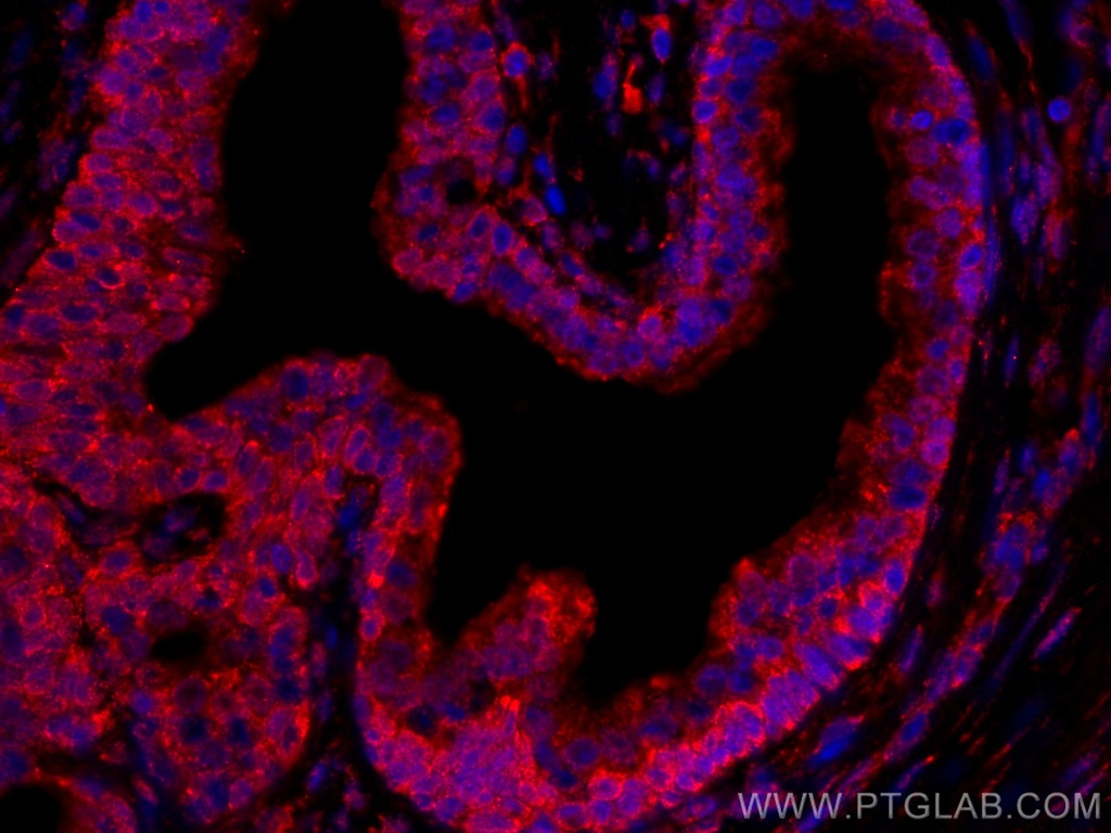 CoraLite®594-conjugated TAOK3 Monoclonal antibody