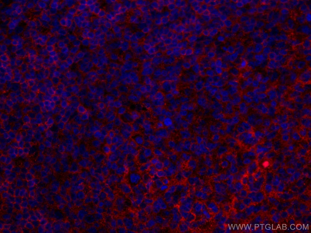 CoraLite®594-conjugated NT5E,CD73 Monoclonal antibody