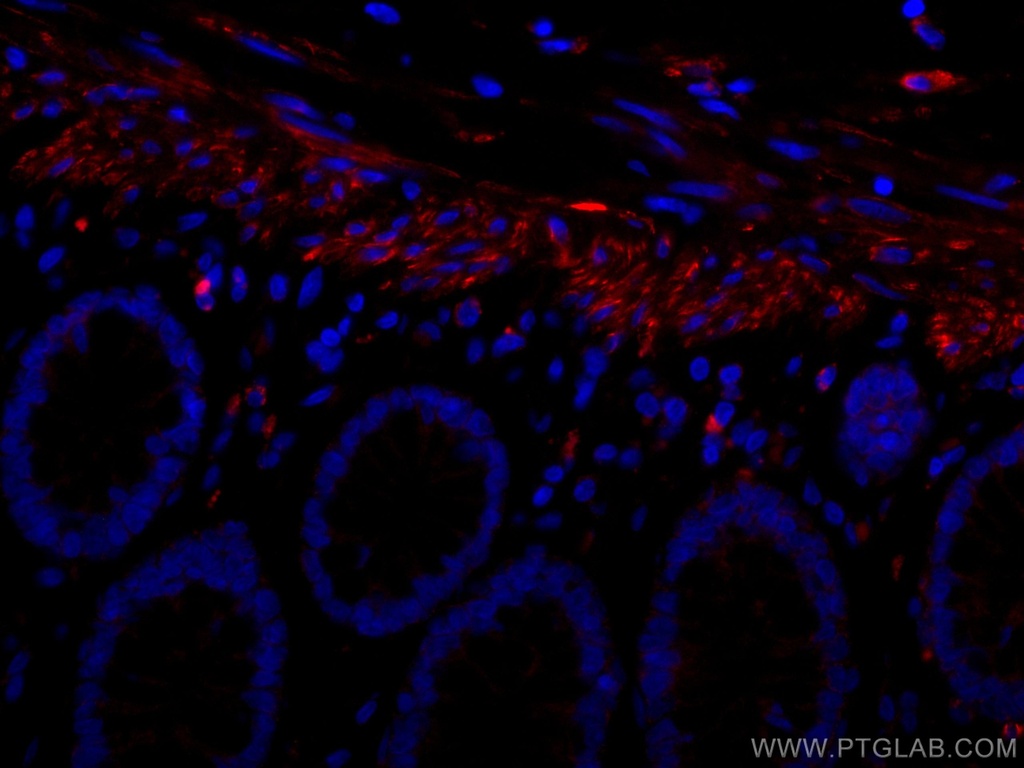 CoraLite®594-conjugated Desmin Monoclonal antibody