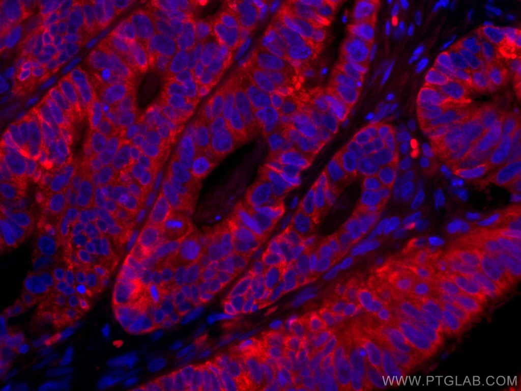 CoraLite®594-conjugated CNOT4 Monoclonal antibody