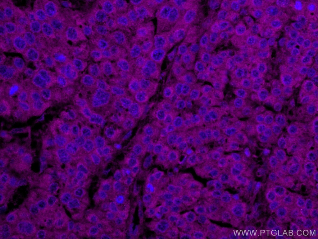 CoraLite®647-conjugated NCAPH Monoclonal antibody