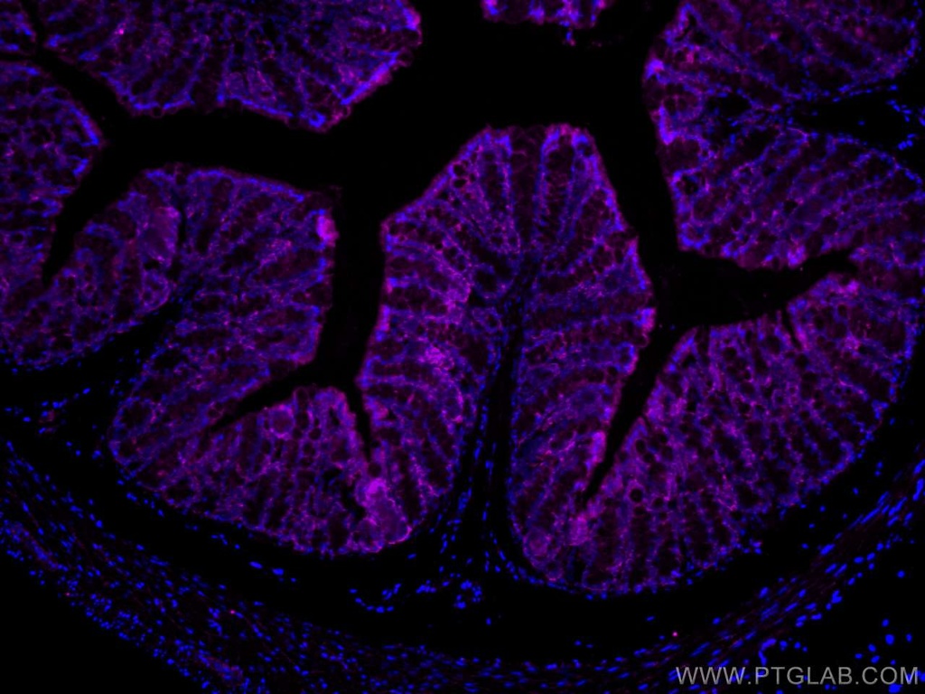CoraLite®647-conjugated FABP2 Monoclonal antibody