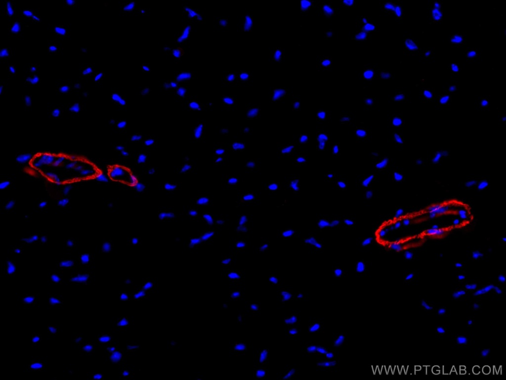 CoraLite®647-conjugated smooth muscle actin specific Monoclonal antibody
