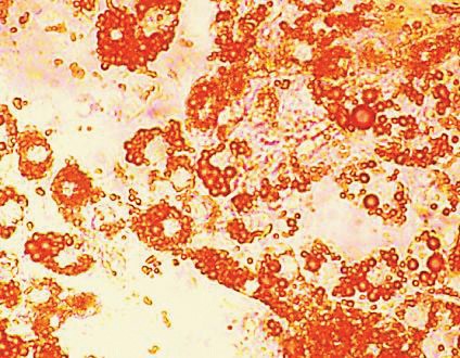 HiDiffTM Adipogenesis Assay Kit     