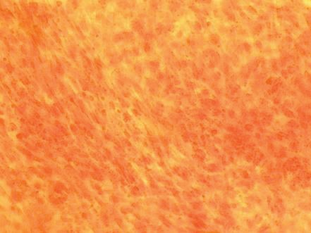 Alizarin Red S