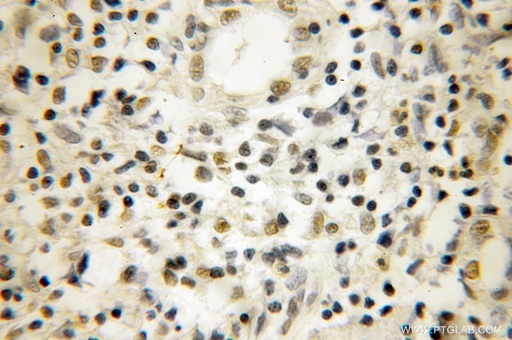 [10091-2-AP-150UL] NOB1 Polyclonal antibody