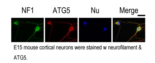 [10181-2-AP-20UL] ATG5 Polyclonal antibody