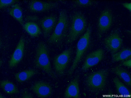 [10202-1-AP-150UL] ARL4C Polyclonal antibody