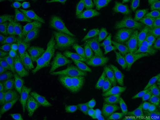 [10247-2-AP-20UL] GNB1 Polyclonal antibody