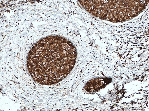 [10249-1-AP-20UL] GDI1 Polyclonal antibody