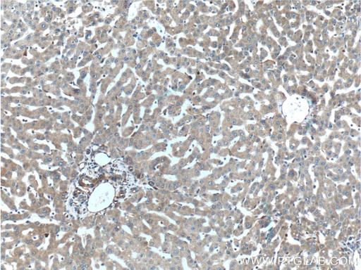 [10251-1-AP-150UL] TIP30 Polyclonal antibody