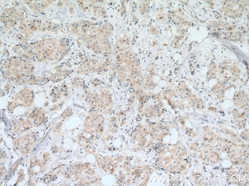 [10252-1-AP-20UL] Cdc20 Polyclonal antibody