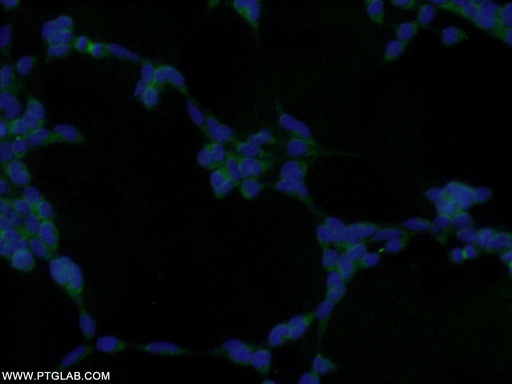 [10254-2-AP-20UL] GRB2 Polyclonal antibody