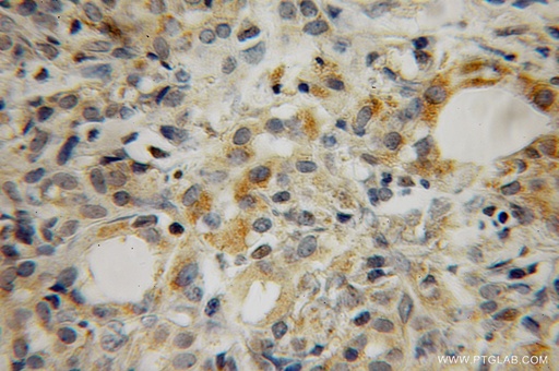 [10267-1-AP-20UL] MEA1 Polyclonal antibody