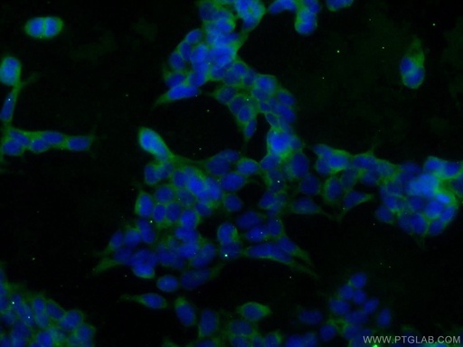 [10269-1-AP-150UL] SOD1 Polyclonal antibody