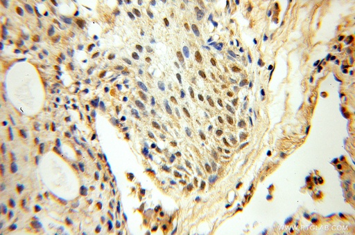 [10271-1-AP-150UL] FAF1 Polyclonal antibody
