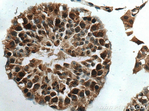 [10272-2-AP-150UL] p19 INK4d Polyclonal antibody