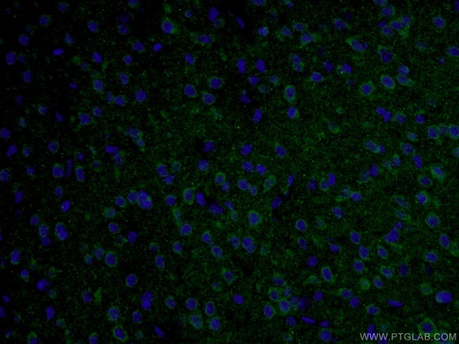 [10274-1-AP-20UL] TAU Polyclonal antibody