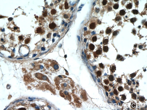 [10280-1-AP-20UL] MAGEC2 Polyclonal antibody