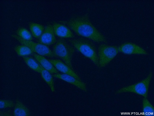 [10290-1-AP-150UL] AMPK Gamma 1 Polyclonal antibody