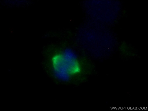 [10297-1-AP-150UL] Aurora A Polyclonal antibody
