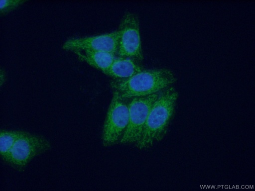 [10310-1-AP-150UL] MPV17 Polyclonal antibody