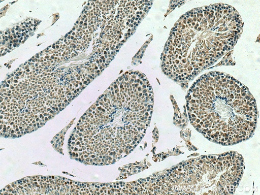 [10321-1-AP-20UL] PPP2R4 Polyclonal antibody