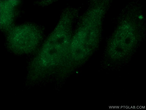[10328-1-AP-20UL] NXF1 Polyclonal antibody