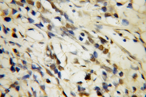 [10334-1-AP-20UL] U2AF35 Polyclonal antibody