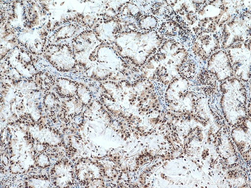 [10341-1-AP-20UL] ACTL6A Polyclonal antibody