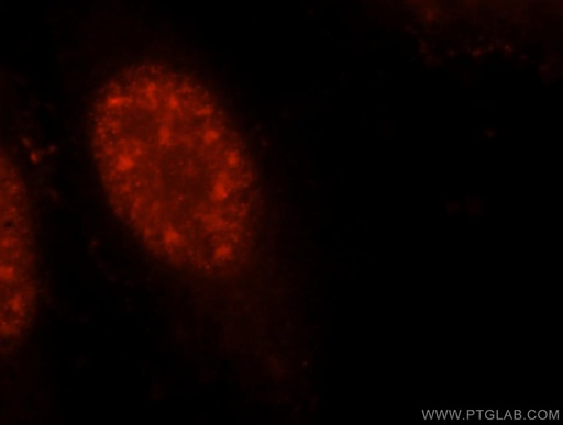 [10344-1-AP-150UL] UBE3A Polyclonal antibody