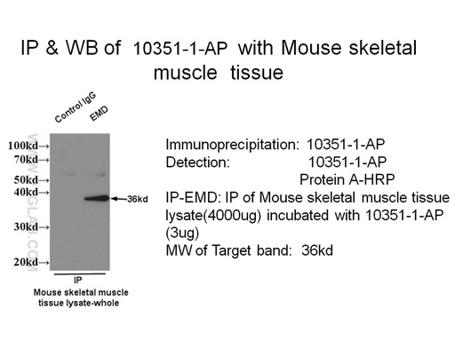 [10351-1-AP-20UL] Emerin Polyclonal antibody