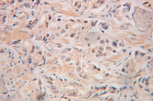 [10354-1-AP-20UL] GRWD1 Polyclonal antibody