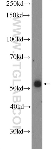 [10360-1-AP-20UL] ZNF256 Polyclonal antibody