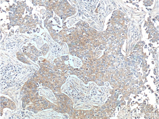 [10369-1-AP-150UL] ERBB3 Polyclonal antibody