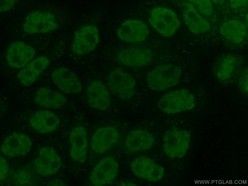 [10378-1-AP-20UL] NEK6 Polyclonal antibody