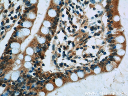 [10379-1-AP-150UL] SNRPD3 Polyclonal antibody