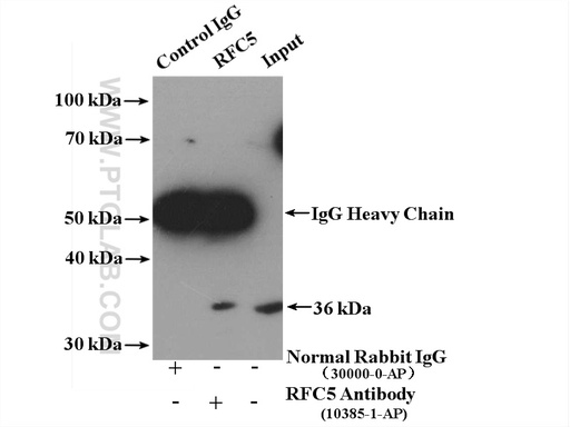 [10385-1-AP-150UL] RFC5 Polyclonal antibody
