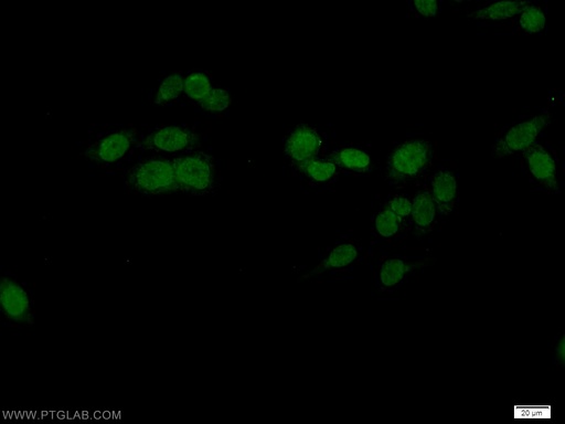 [10387-1-AP-20UL] OCT1 Polyclonal antibody