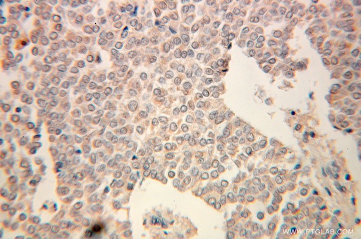 [10391-1-AP-20UL] UGP2 Polyclonal antibody