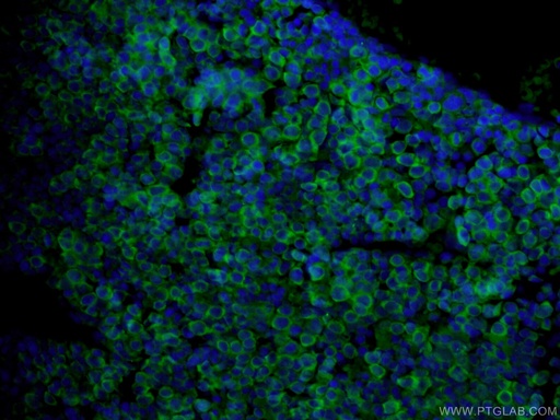 [10392-1-AP-20UL] USP2 Polyclonal antibody