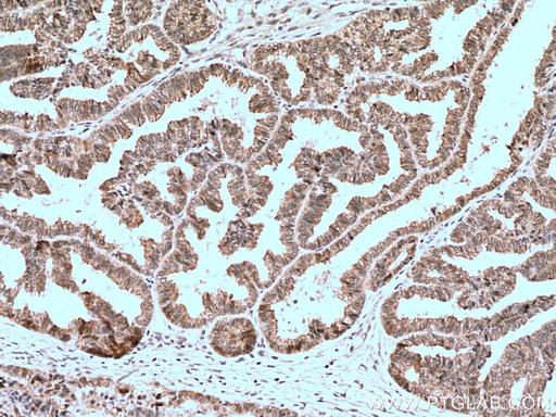 [10398-1-AP-150UL] BAP1 Polyclonal antibody