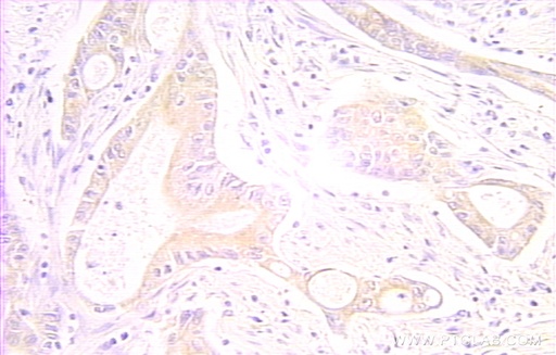 [10401-1-AP-150UL] RAIDD Polyclonal antibody