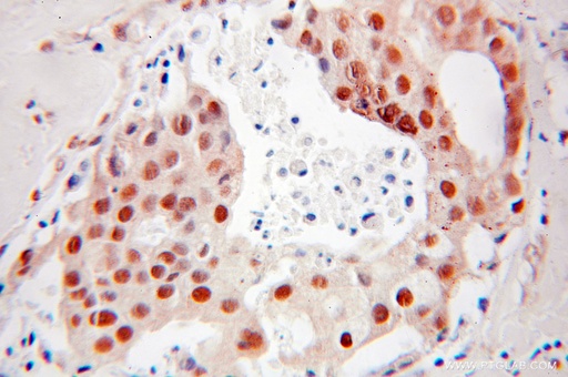 [10406-1-AP-150UL] DR1 Polyclonal antibody