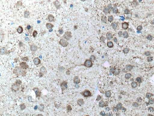 [10408-1-AP-20UL] GAD1 Polyclonal antibody