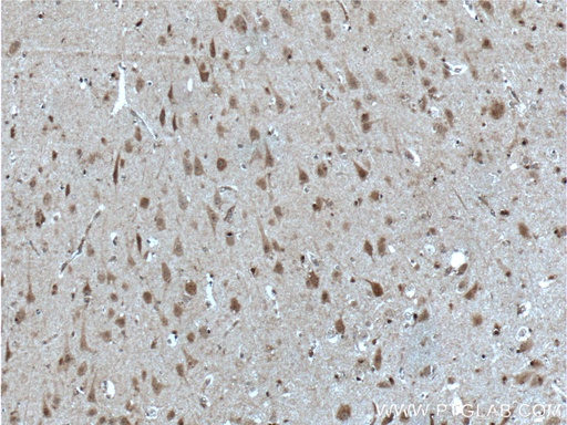 [10422-1-AP-20UL] SOX10 Polyclonal antibody