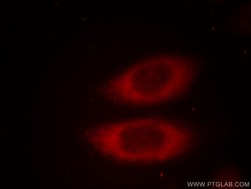 [10424-1-AP-20UL] JTV1 Polyclonal antibody