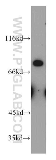 [10428-1-AP-150UL] MFI2 Polyclonal antibody