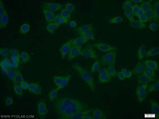 [10429-1-AP-20UL] SMAD1 Polyclonal antibody