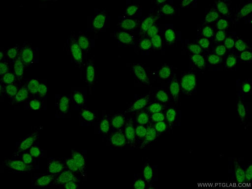 [10431-1-AP-20UL] DDB2 Polyclonal antibody